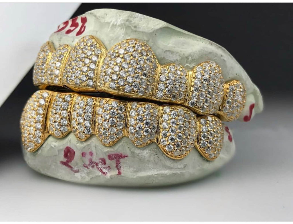 Custom Grillz – The W Brothers